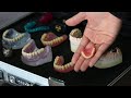 差し歯・入れ歯を作る工程。毎日大量のオーダーメイドの歯を作る歯科技工士。