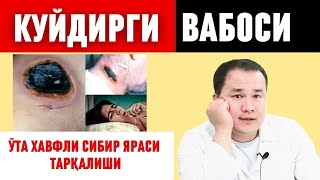 ЭНДИ БУ ВАБО КАСАЛЛИК КУЙДИРГИ ЯРАСИ ТАРҚАЛИШИ ЮҚИШ ЙЎЛЛАРИ ВА САҚЛАНИШ/ СИБИРСКАЯ ЯЗВА ЎТА ХАВФЛИ