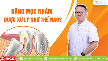 Xử lí răng mọc ngầm như thế nào? Khi nào giữ lại, khi nào cần nhổ bỏ