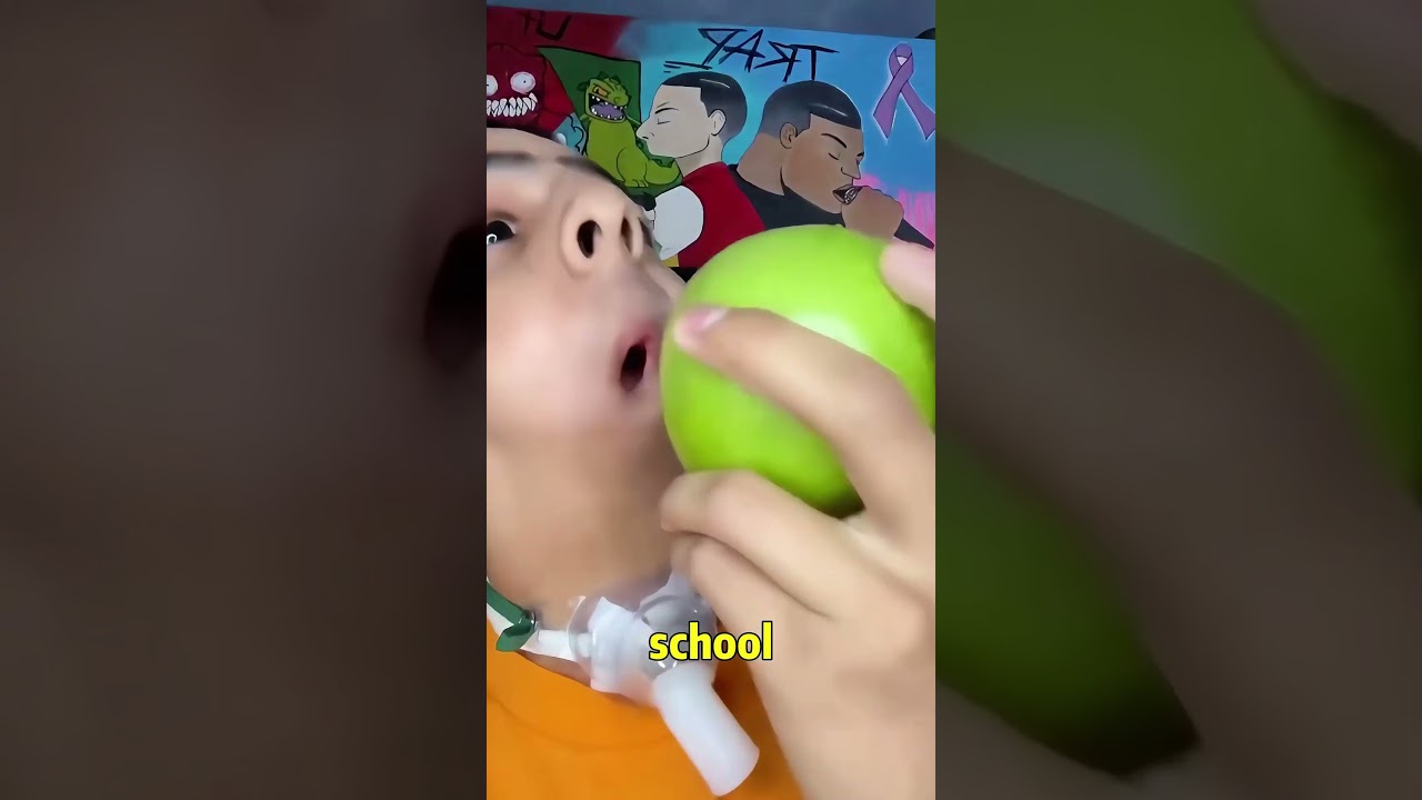 How does he eat with no chin , His story's absolutely inspiring