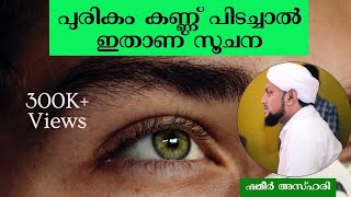 പരകകണണ പടചചൽ ഇതണ സചന Purikamkannu Pidachaal Shameer Azhari Azhariz Vlog