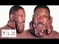 Chronic Keloids Are Seriously Impacting This Man's Life | Body Bizarre