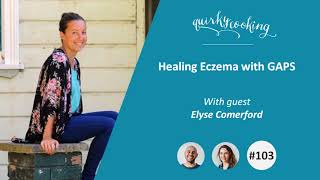 Healing Eczema with GAPS - A Quirky Journey Podcast #103
