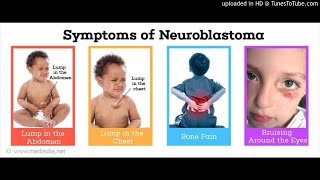Neuroblastoma