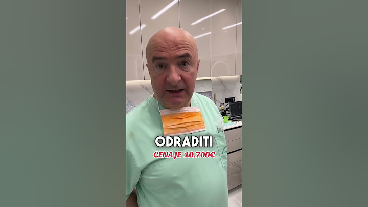 OPET VADIMO SVE ZUBE💪🏻