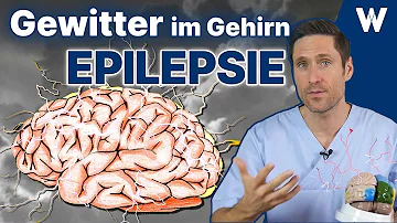 Was ist der Auslöser für epileptische Anfälle?