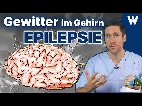 Video: Wo im Gehirn treten epileptische Anfälle auf?