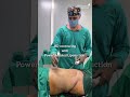 HD Liposuction with Vibrasat Pro | Advanced Body Contouring in Pune