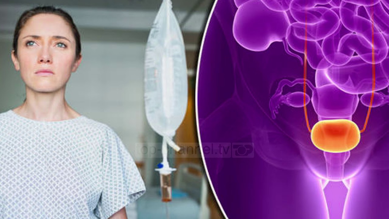 Në shtëpinë tonë/ Infeksionet urinare dhe vaginale, mjekja: Kujdes nga tualetet e lokaleve