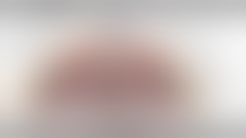 Robotic Transabdominal Retrorectus Repair. r-TARUP . Narrated. Houston, tx