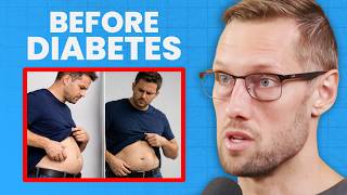 The EARLIEST Signs You’re Becoming Insulin Resistant | Dr. Andrew Koutnik