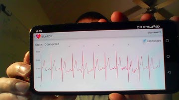 STM32 and Android tutorial - ECG (single lead, 2 and 3 electrode configuration)