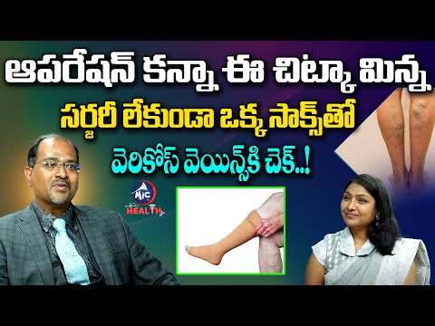 సర్జరీ లేకుండా ఒక్క సాక్స్ తో | The Benefits Of Compression Stockings For Varicose Veins |