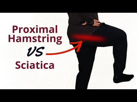 Proximal Hamstring Tendinopathy vs. Sciatica: What's Causing The Pain?