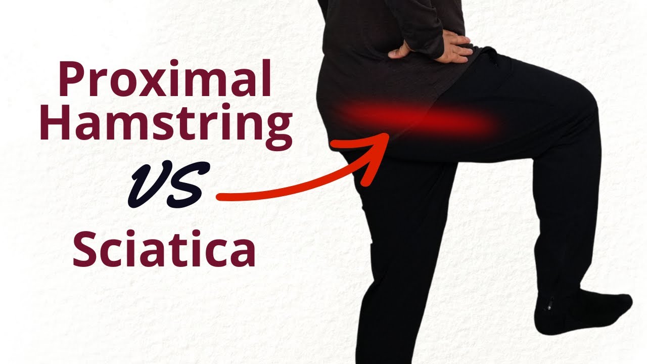 Тендинопатия проксимального отдела подколенного сухожилия и ишиас: что вызывает боль?