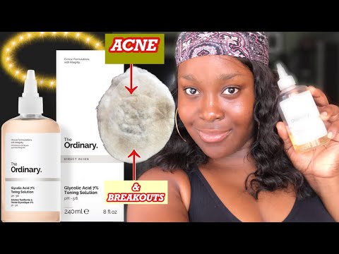 THE ORDINARY GLYCOLIC ACID 7% TONING SOLUTION| REMOVES DIRT AND CLEARS ACNE  AND TEXTURE - YouTube