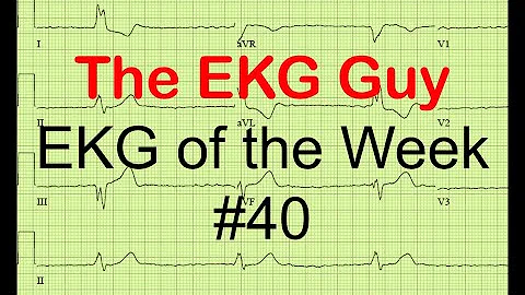EKG / ECG of the Week #40 l The EKG Guy - www.ekg.md
