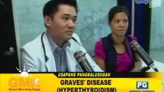 Graves Disease (Hyperthyroidism)