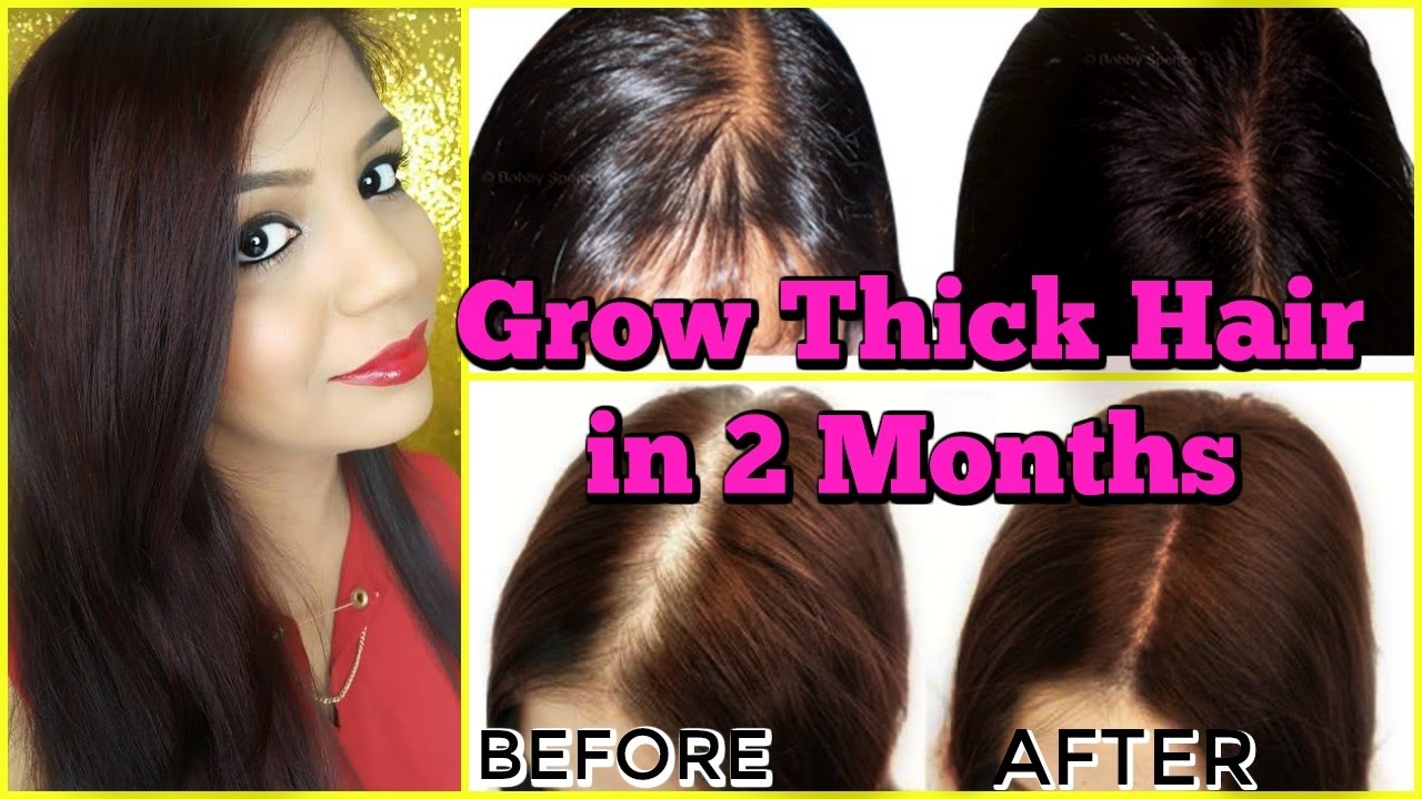 Fast Hair Growth Treatment Grow new Hair in 2 Months | SuperPrincessjo -  YouTube