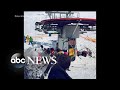 11 people were injured on a broken ski lift in Eastern Europe