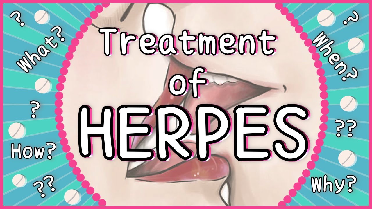 Herpes Virus Treatment