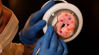 ASMR Satisfying Squishy Ear Cleaning Treatment | Pink Parasites, Scraping & Extractions screenshot 1