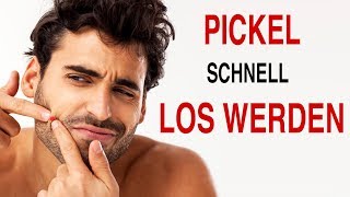 PICKEL LOSWERDEN ● Wie man einen Pickel über Nacht loswerden kann | DANIEL KORTE