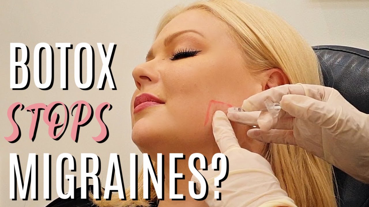 You Can Get Botox For Migraines I Had To Try It Youtube