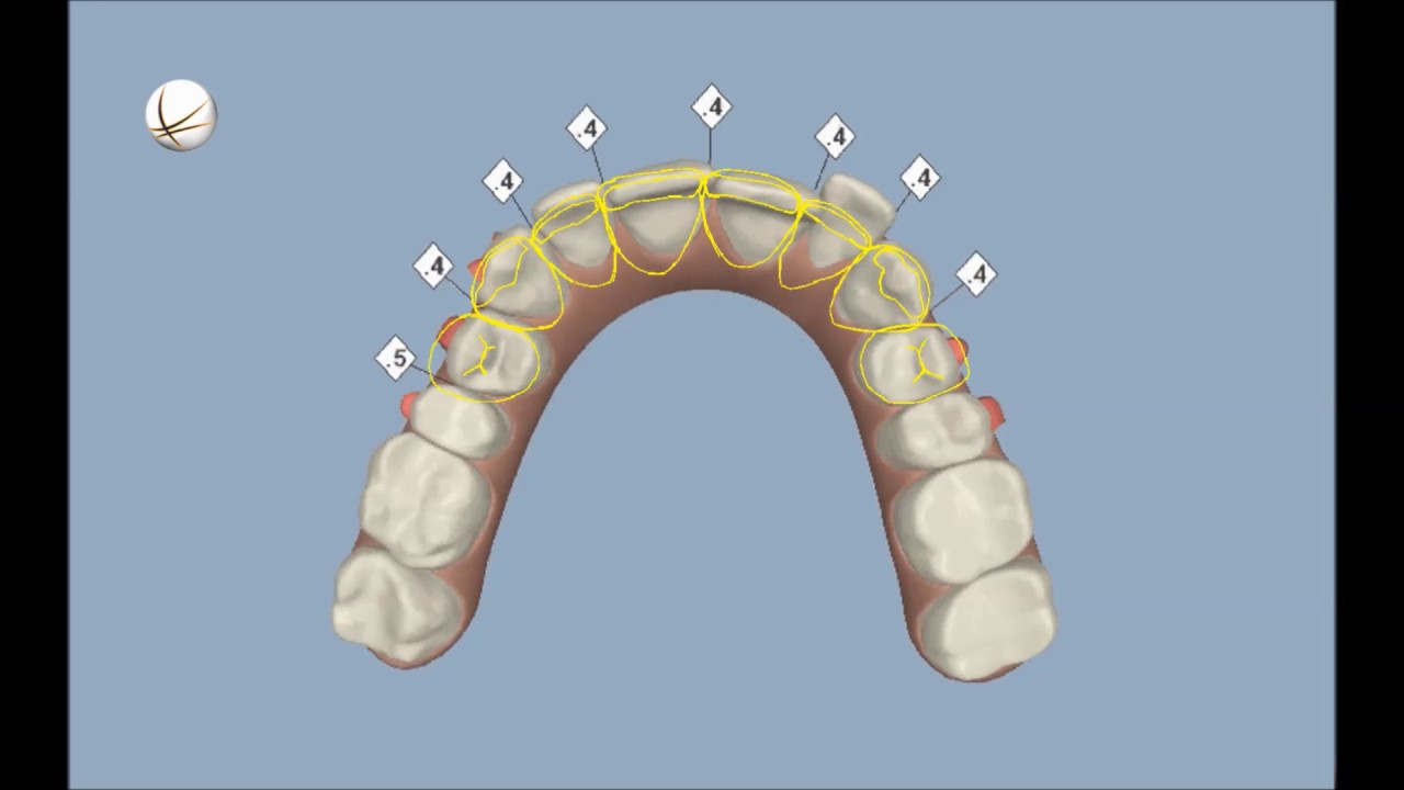 DSD CONNECT Examples - YouTube