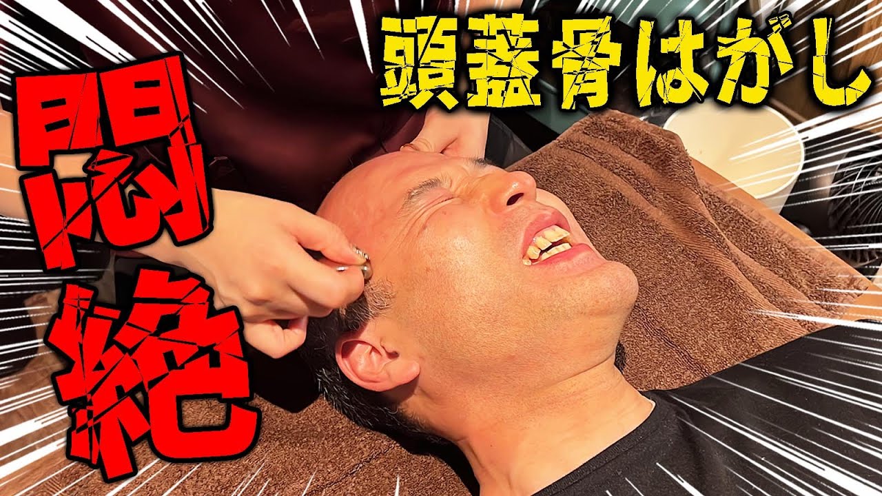 頭蓋骨にナイフ