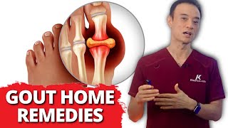 (Relief Fast) 6 Home Remedies For Gout!