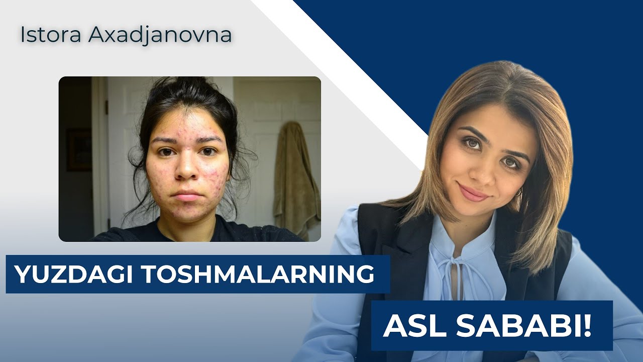 Toshmalarning asl sababi nimadan? Gormonal sabablar tufaylimi? 