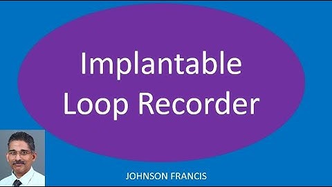 Implantable Loop Recorder