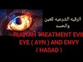 Ruqyah treatment evil eye  ayn  and envy  hasad 