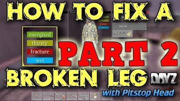 Fix a Broken Leg in DayZ Standalone - Part 2