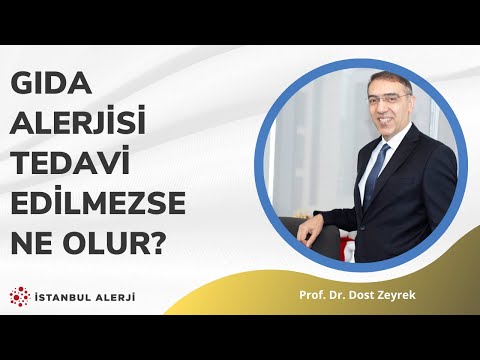 Gıda alerjisi tedavi