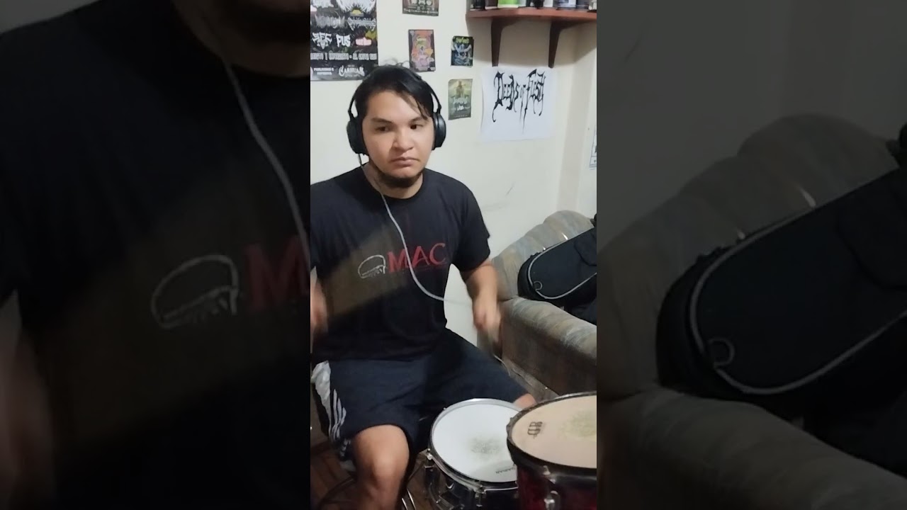 Anastomosis After Intraoperative Colonic Lavage (Guitar & Drums)