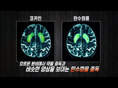 ‘<strong>탄수화물</strong> <strong>중독</strong>’ 원인! 과잉섭취가 주는 위험