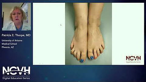 Dr. Patricia Thorpe, Combined Superficial Venous I...