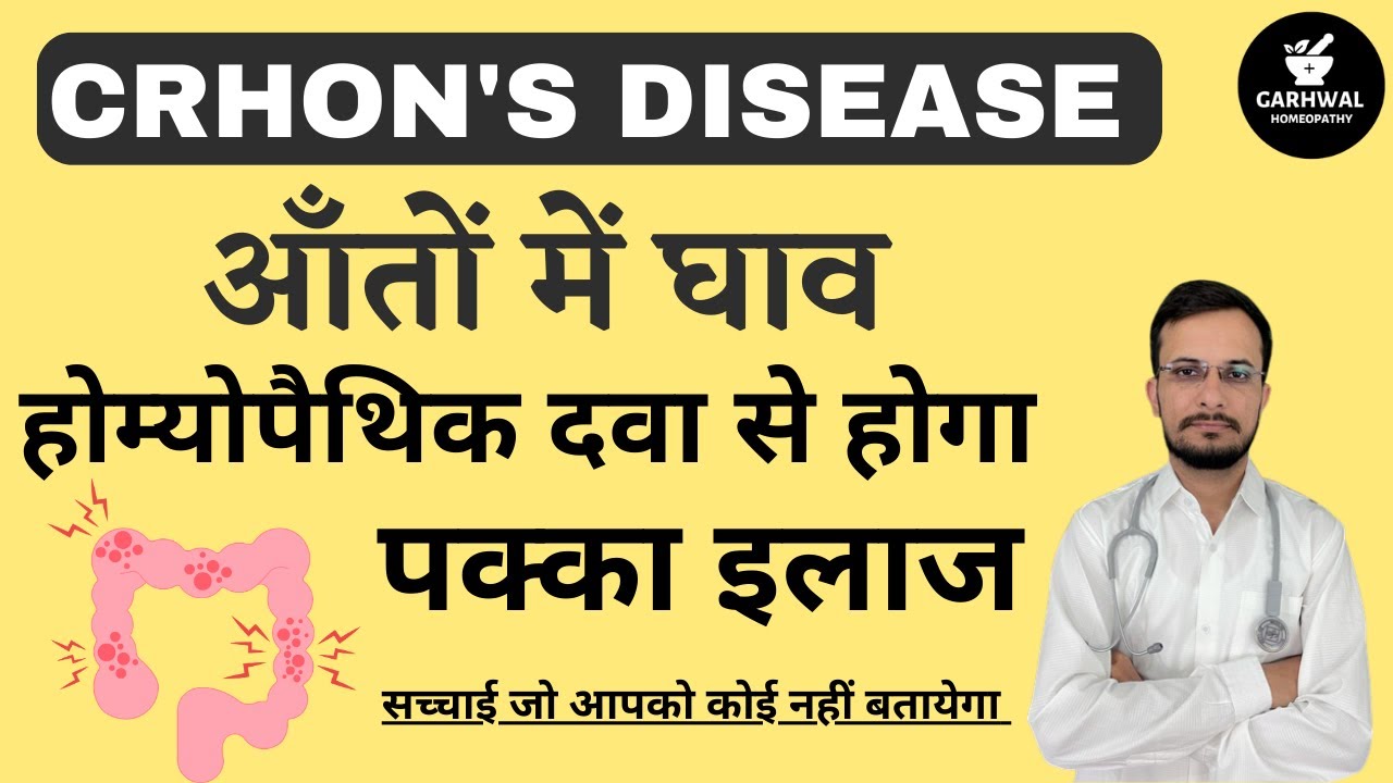 Crohn's disease Homeopathic Treatment Homeopathic Treatment of Crohn
