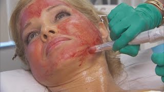 Former 'Baywatch' Actress Donna D'Errico Uses Blood For Extreme Beauty Regime