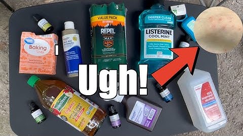 Chigger Tips: Mostly Home Remedies For Bite Relief, and Repellent