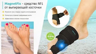 ВЫСТУП КОСТОЧКИ НА НОГЕ ВЫПИРАЕТ СЗАДИ 🤕