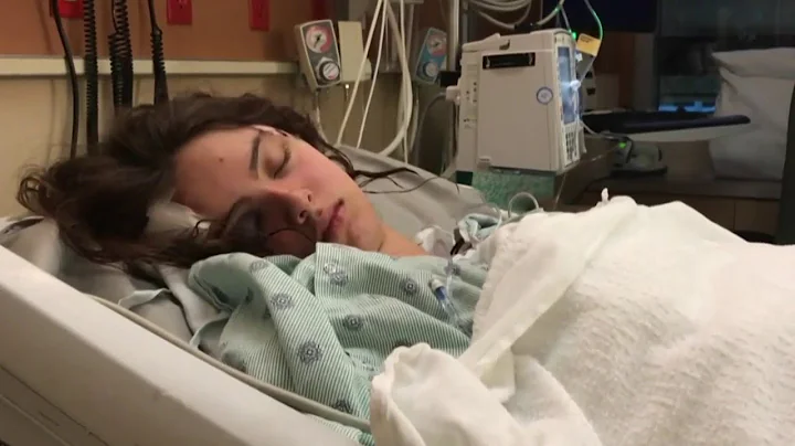 FIU steps up security after 2 high school students beaten on Biscayne Bay Campus