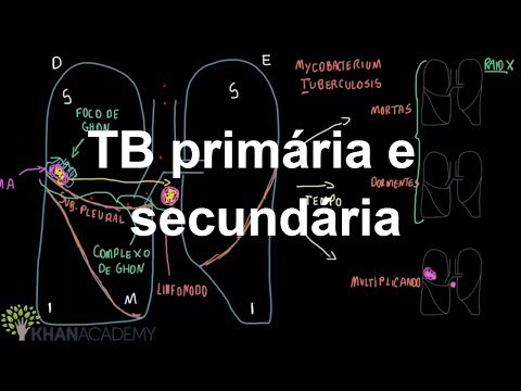 Vídeo: Diferença Entre Tuberculose Primária E Secundária