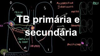 TB primária e secundária | Vida e medicina | Khan Academy