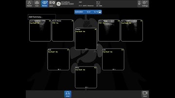 Venue™ Family R3 Tutorial - eFAST