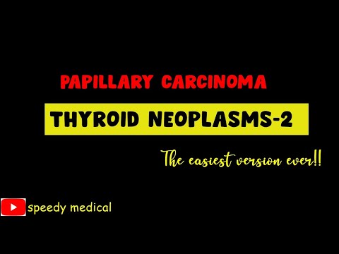 Papillary Carcinoma of Thyroid | Thyroid Neoplasms Made Easy | usmle step 1 step 2CK |