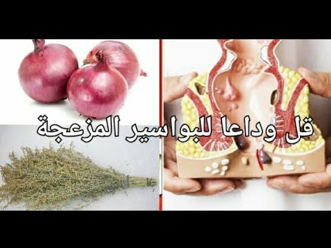 علاج  البواسير الداخلية والخارجية والشرخ الشرجي نهائيا بدون جراحة ولا تكاليف باهظة