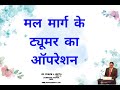 मल मार्ग के ट्यूमर का ऑपरेशन